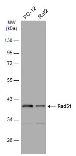 Genetex Inc Rad51 antibody [N1C2], 100 uL, Quantity: Each of 1