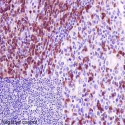 Abcam Rabbit monoclonal [EPR4517] to CD3G, Quantity: Each of 1