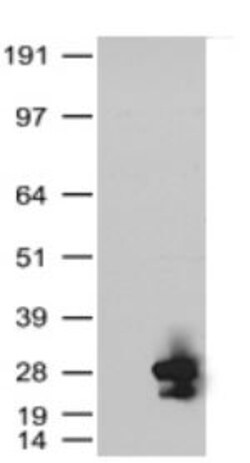 Vector Laboratories Monoclonal Mouse anti‑Human KRAS Antibody (clone 2C1,