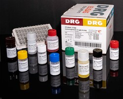 Drg International Inc Immunoglobulin E (Ige) Elisa, Quantity: Each of 1