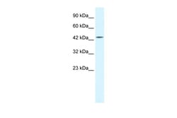 Aviva Systems Biology Corp IKBKG Antibody - middle region (ARP30005_T100)