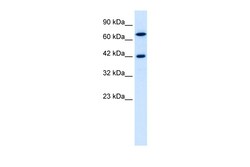 Aviva Systems Biology Corp C20ORF100 Antibody - N-terminal region (ARP30008_P050)