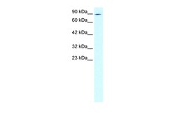 Aviva Systems Biology Corp ZNF341 Antibody - N-terminal region (ARP30013_T100)