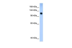 Aviva Systems Biology Corp SMARCA5 Antibody - N-terminal region (ARP30031_P050)