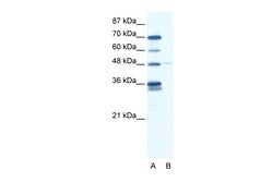 Aviva Systems Biology Corp GLIS2 Antibody - N-terminal region (ARP30036_T100)