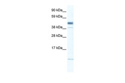 Aviva Systems Biology Corp ZMAT1 Antibody - middle region (ARP30058_P050)