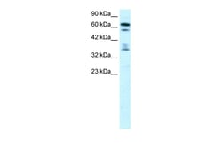 Aviva Systems Biology Corp ZNF512 Antibody - middle region (ARP30060_P050)