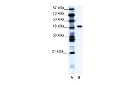 Aviva Systems Biology Corp ZNF541 Antibody - middle region (ARP30068_T100)