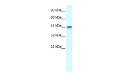 Aviva Systems Biology Corp GFI1B Antibody - N-terminal region (ARP30093_P050)
