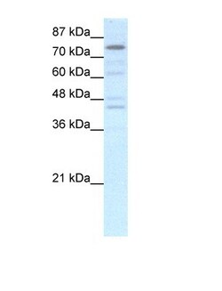 Aviva Systems Biology Corp EOMES Antibody - N-terminal region (ARP30096_P050)