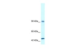 Aviva Systems Biology Corp RBM10 Antibody - N-terminal region (ARP30103_T100)