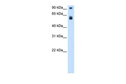 Aviva Systems Biology Corp TAF15 Antibody - N-terminal region (ARP30112_P050)