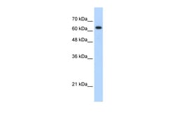 Aviva Systems Biology Corp RAD17 Antibody - C-terminal region (ARP30206_T100)