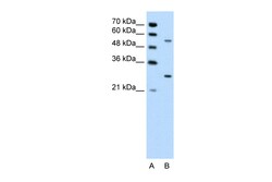 Aviva Systems Biology Corp PDPK1 Antibody - middle region (ARP30313_P050)