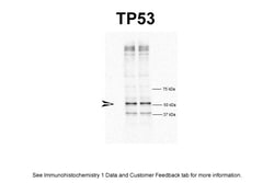 Aviva Systems Biology Corp TP53 Antibody - N-terminal region (ARP30370_P050)