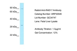 Aviva Systems Biology Corp RAD17 Antibody - N-terminal region (ARP30546_P050)