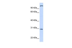 Aviva Systems Biology Corp TLR2 Antibody - C-terminal region (ARP30551_P050)