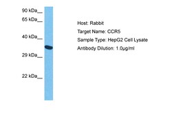 Aviva Systems Biology Corp CCR5 Antibody - middle region (ARP30788_P050)