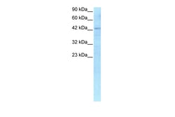 Aviva Systems Biology Corp RBPSUH Antibody - C-terminal region (ARP31121_P050)