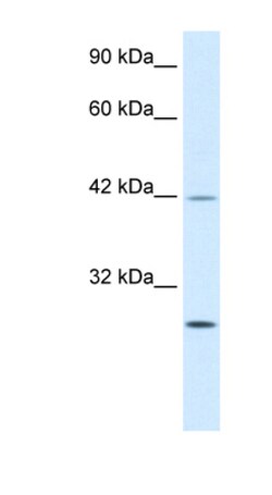 Aviva Systems Biology Corp KLF9 Antibody - N-terminal region (ARP31369_P050)