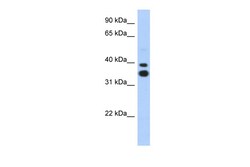 Aviva Systems Biology Corp MSX2 Antibody - N-terminal region (ARP31398_P050)