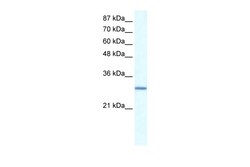 Aviva Systems Biology Corp GTF2E2 Antibody - N-terminal region (ARP31434_P050)