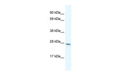 Aviva Systems Biology Corp GTF2F2 Antibody - C-terminal region (ARP31436_P050)