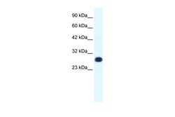 Aviva Systems Biology Corp GTF2F2 Antibody - middle region (ARP31437_T100)