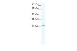 Aviva Systems Biology Corp PQBP1 Antibody - middle region (ARP31454_T100)