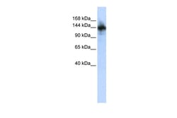 Aviva Systems Biology Corp RBM6 Antibody - N-terminal region (ARP31461_P050)