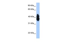 Aviva Systems Biology Corp OLIG2 Antibody - N-terminal region (ARP31464_P050)