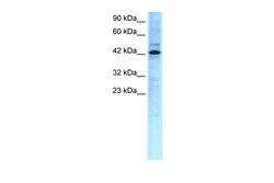 Aviva Systems Biology Corp TCFL5 Antibody - middle region (ARP31500_P050)