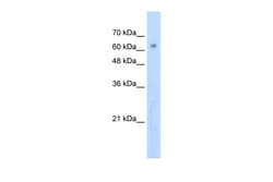 Aviva Systems Biology Corp ZNF274 Antibody - N-terminal region (ARP31504_T100)