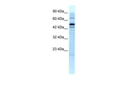 Aviva Systems Biology Corp SALF Antibody - C-terminal region (ARP31514_T100)
