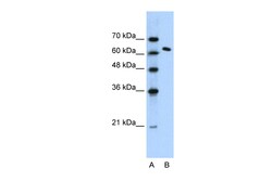 Aviva Systems Biology Corp SUPT16H Antibody - N-terminal region (ARP31526_T100)