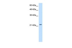 Aviva Systems Biology Corp PMF1 Antibody - middle region (ARP31527_T100)