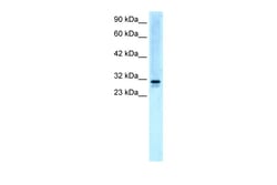 Aviva Systems Biology Corp EAP30 Antibody - N-terminal region (ARP31531_P050)