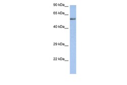 Aviva Systems Biology Corp ZNF513 Antibody - N-terminal region (ARP31555_P050)