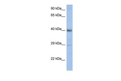 Aviva Systems Biology Corp ZNF474 Antibody - middle region (ARP31557_P050)