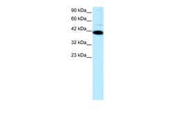 Aviva Systems Biology Corp ZFP1 Antibody - N-terminal region (ARP31586_P050)