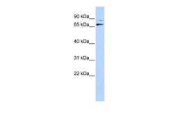 Aviva Systems Biology Corp DLX4 Antibody - middle region (ARP31606_P050)