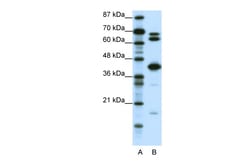 Aviva Systems Biology Corp E2F2 Antibody - middle region (ARP31611_P050)