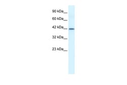 Aviva Systems Biology Corp ESR2 Antibody - N-terminal region (ARP31652_P050)