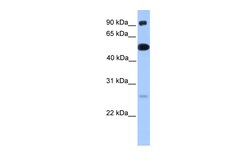 Aviva Systems Biology Corp ETV5 Antibody - N-terminal region (ARP31658_P050)