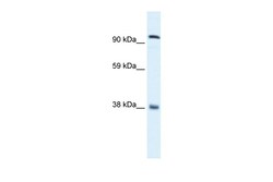 Aviva Systems Biology Corp EVI1 Antibody - C-terminal region (ARP31659_P050)