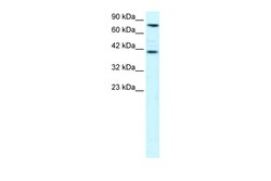 Aviva Systems Biology Corp ZNF652 Antibody - N-terminal region (ARP31678_P050)