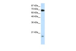 Aviva Systems Biology Corp TRIM32 Antibody - C-terminal region (ARP31692_P050)