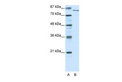 Aviva Systems Biology Corp FBXL11 Antibody - N-terminal region (ARP31697_P050)