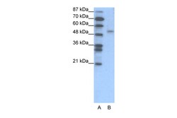 Aviva Systems Biology Corp FOXD2 Antibody - N-terminal region (ARP31709_T100)
