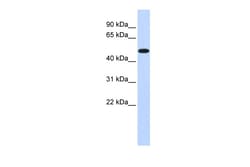 Aviva Systems Biology Corp PDK2 Antibody - middle region (ARP31778_P050)